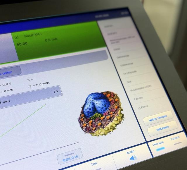 HiToP® Bedienoberfläche: präzise Dosierung von Stromstärke und Energie
